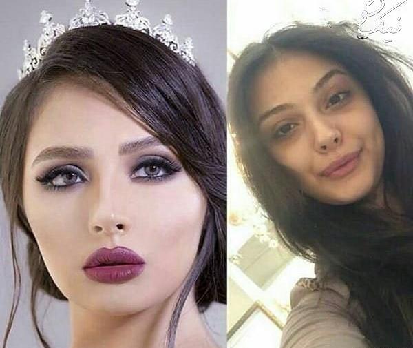 عکس های قبل و بعد عروس
