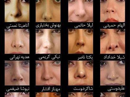 عکس نوشته طنز دماغ عملی