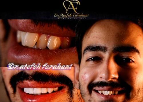 عکس نوشته علم بهتر است یا ثروت