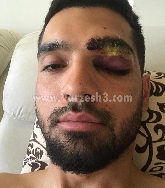 عکس پدر مهدی مهدی پور