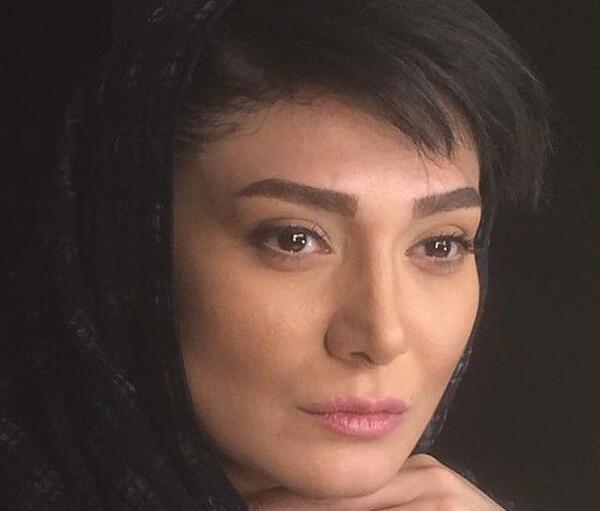 عکس مینا وحید قبل از عمل بینی