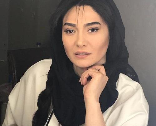 عکس مینا وحید قبل از عمل بینی