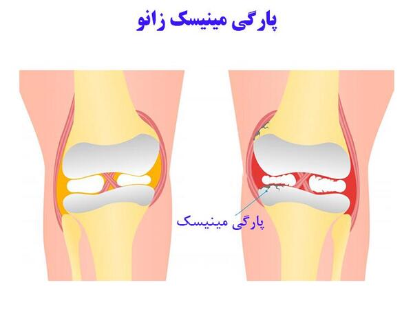 عکس صفحه رشد بسته زانو