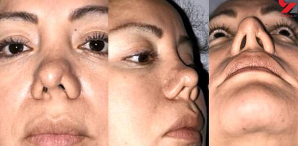 عکس زنان جراحی زیبایی
