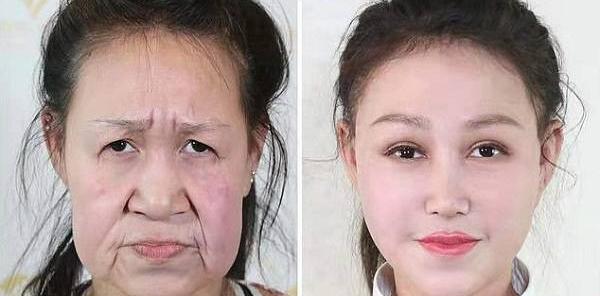 عکس زنان جراحی زیبایی