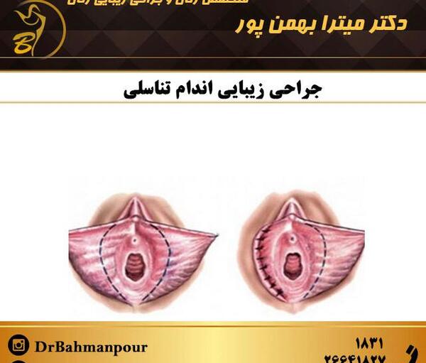 عکس زنان جراحی زیبایی