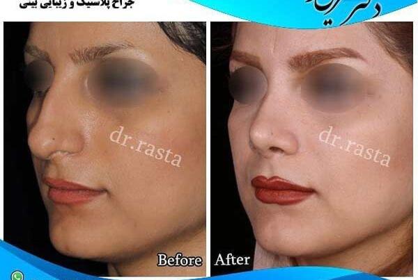 عکس زنان جراحی زیبایی