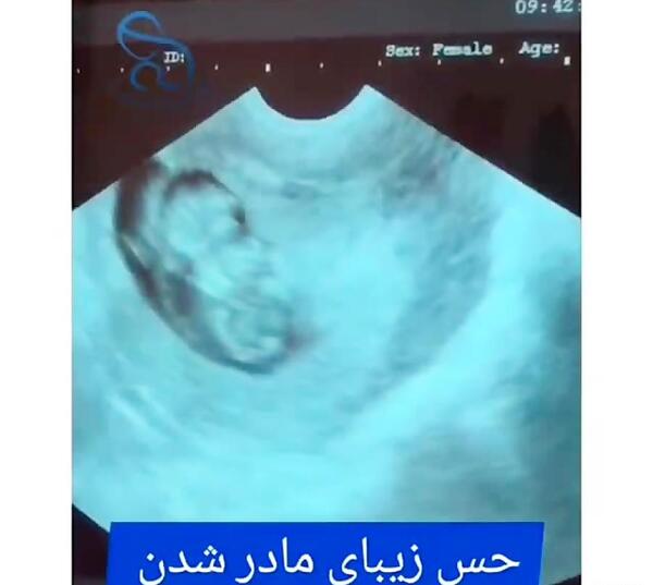 عکس مادر شدن