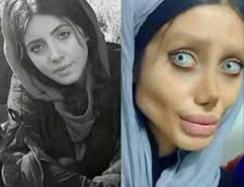 عکس زامبی خارجی