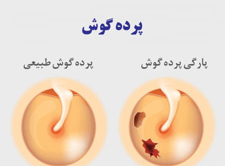 عکس خرگوش گوش بلند