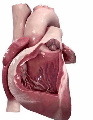عکس قلب انسان مرده