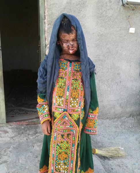 عکس دختر کوچولو بلوچ