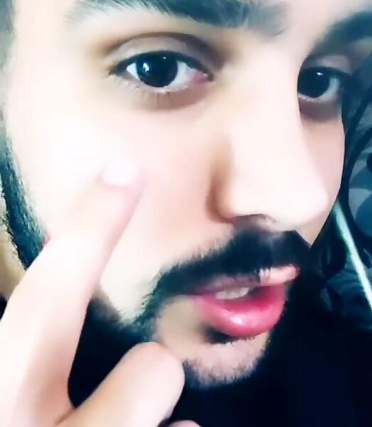 عکس آرمین احمدی قبل از عمل