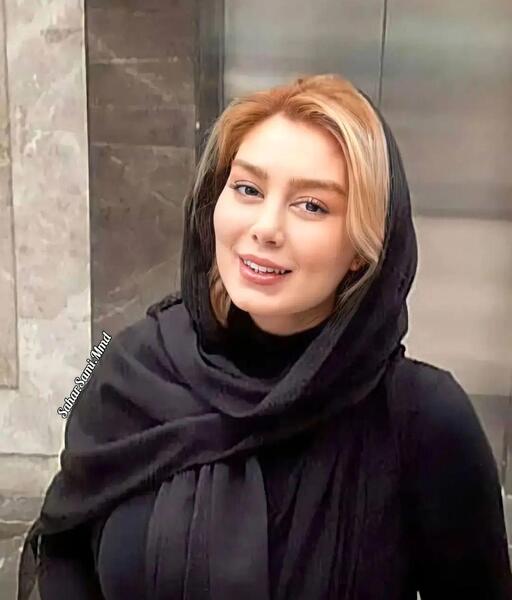 عکس صورت زخمی سحر قریشی