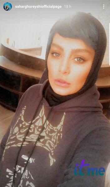 عکس صورت زخمی سحر قریشی