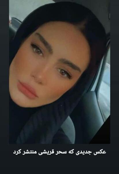 عکس صورت زخمی سحر قریشی
