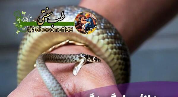 عکس مار گزیدگی