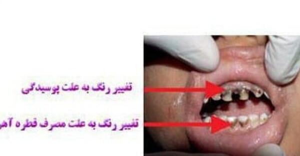 عکس قطره مولتی ویتامین میم اورنج