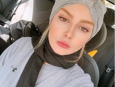 عکس سحر قریشی قبل از عمل جراحی