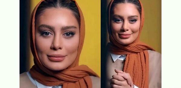 عکس سحر قریشی قبل عمل زیبایی