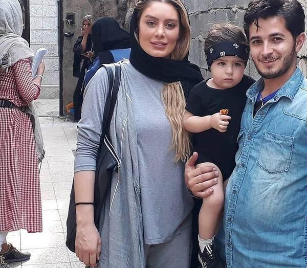 عکس سحر قریشی قبل عمل زیبایی