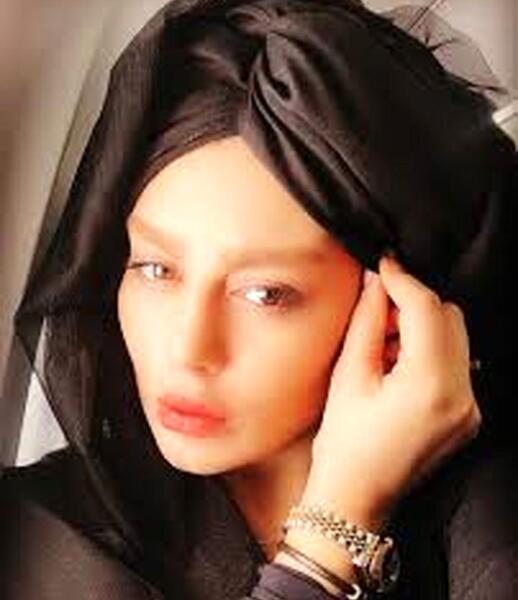 عکس تزریق ژل لب سحر قریشی