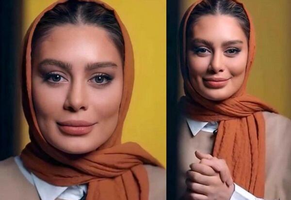 عکس تزریق ژل لب سحر قریشی