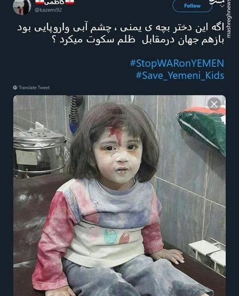 عکس دختر بچه ی چشم ابی
