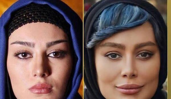 عکس صورت سحر قریشی