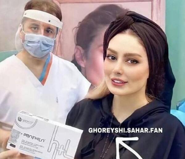 عکس صورت سحر قریشی