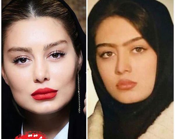 عکس صورت سحر قریشی
