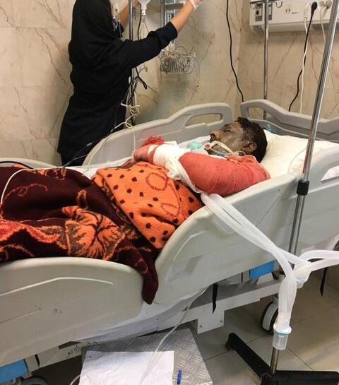 عکس سوختگی سجاد رزمجو که فوت کرده