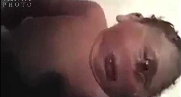 عکس دختر یک چشم در اصفهان