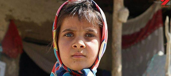 عکس دختر چشم دورنگ