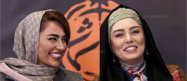 عکس سحر قریشی قبل از عمل دماغ