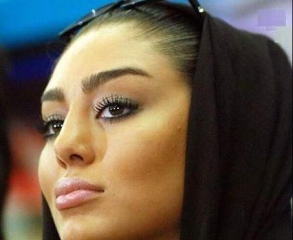عکس سحر قریشی قبل از عمل و بعد از عمل