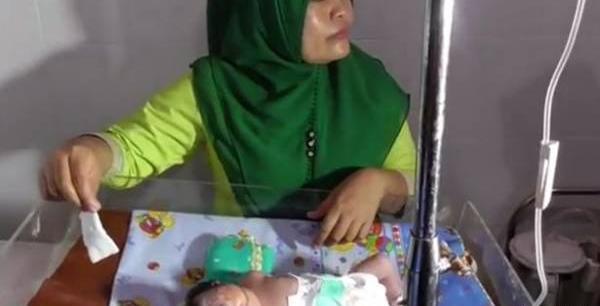 عکس کودک سه چشم