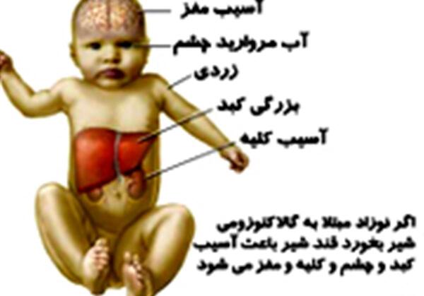 عکس کودکان کند ذهن