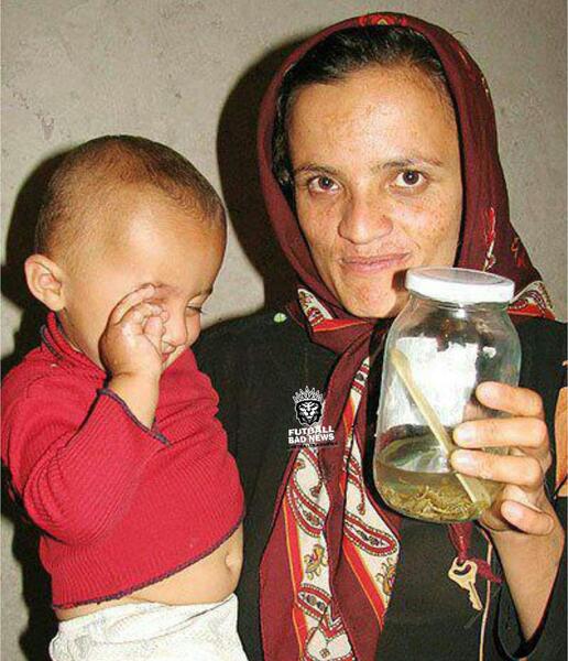 عکس کودک مرده
