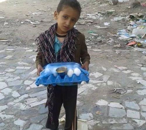 عکس کودک جنگ زده