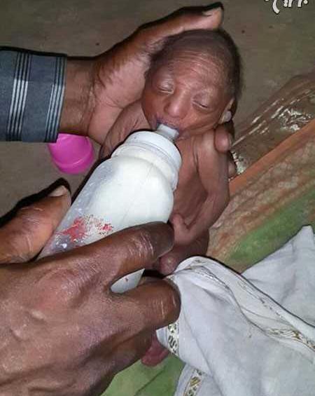 عکس کودک تازه به دنیا اومده
