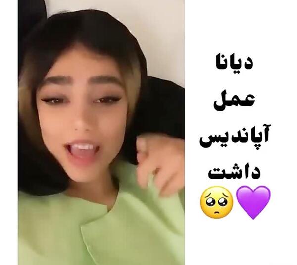 عکس دیانا رحیمی قبل از عمل بینی