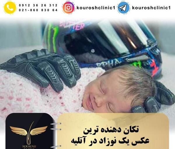 عکس آتلیه نوزاد تازه متولد شده