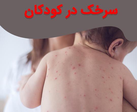 عکس کودک مبتلا به سرخک