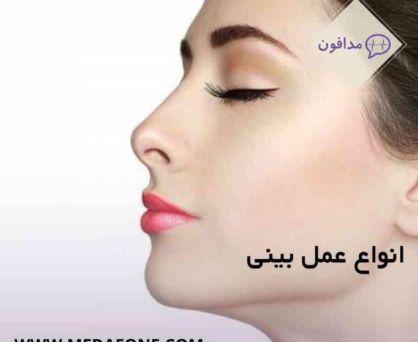 عکس اتلیه قبل عمل بینی