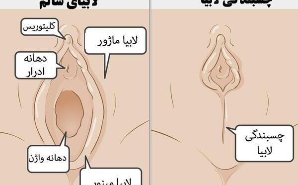 عکس نی نی دختر با اسم
