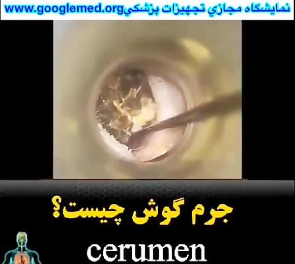 عکس و تصاویر جرم گوش