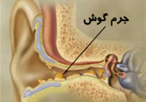عکس و تصاویر جرم گوش