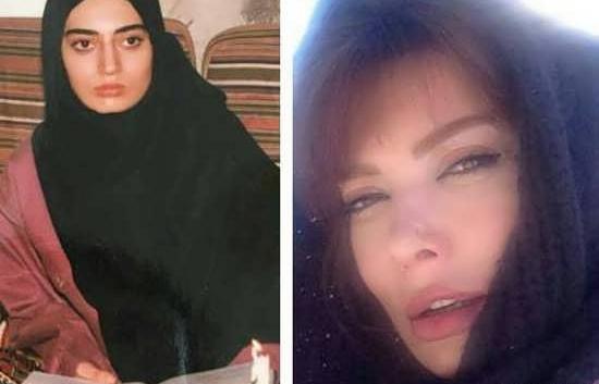 عکس ارغوان قبل از عمل