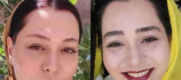 عکس های سانیا سالاری قبل از عمل زیبایی